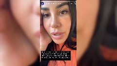 Milla Jasmine : Elle veut se débarrasser de tout l'acide hyaluronique dans son corps !