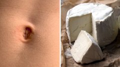 Ils fabriquent du fromage avec des bactéries trouvées dans le nombril de célébrités