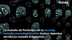 Qu'est-ce que la maladie de Parkinson ?