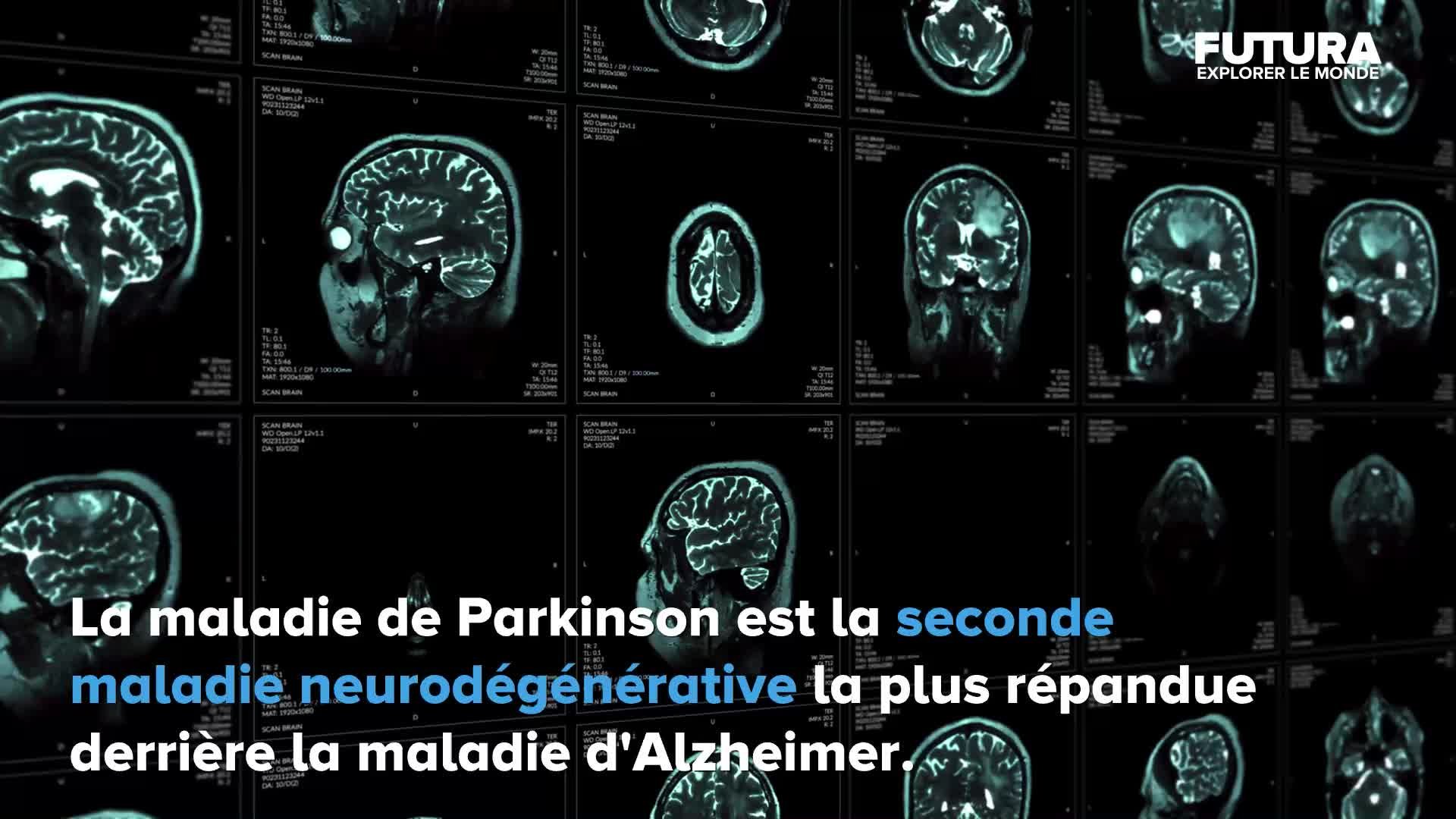 Une IA capable de prédire la maladie de Parkinson à partir de la respiration