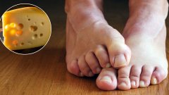 Pourquoi vos pieds sentent-ils le fromage ?