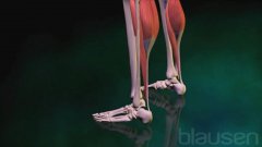 Déchirure du tendon d’Achille