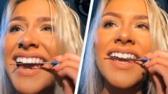 Tendance TikTok : se raccourcir les dents avec des limes à ongles