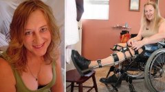 Cette femme veut devenir handicapée à vie parce qu'elle trouve ça stylé et cool