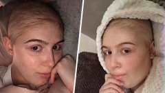 Cette jeune femme de 18 ans dévoile sa transformation des mois après avoir terminé sa chimiothérapie