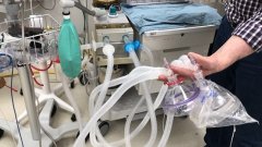 Un anesthésiste canadien réussit à utiliser un respirateur pour neuf personnes, une avancée majeure