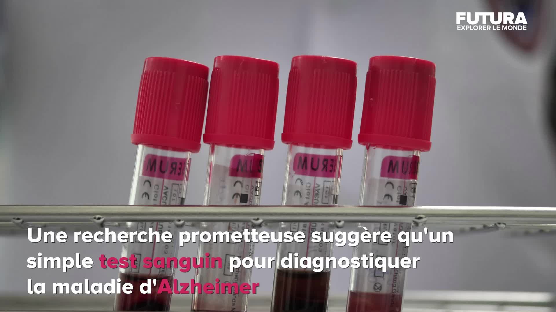 Bientôt un test sanguin pour dépister la maladie d'Alzheimer ? | Futura