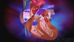 Cardiopathie congénitale