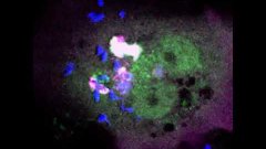 Comment la bactérie de la tuberculose tue les macrophages | Futura