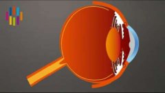 Le glaucome touche 70 millions de personnes dans le monde