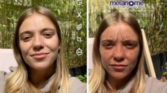 Un filtre Snapchat qui vous montre l'état de votre peau si vous aviez trop pris le soleil