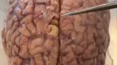 Observation d’un cerveau humain | Futura