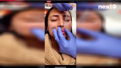 Astrid Nelsia : Elle film sa dernière intervention esthétique sur Snapchat !
