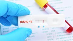 Diagnostic du COVID19 : le point sur les tests