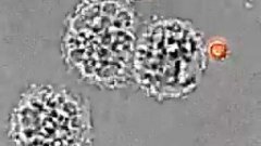 Un macrophage en action : il dévore une conidie